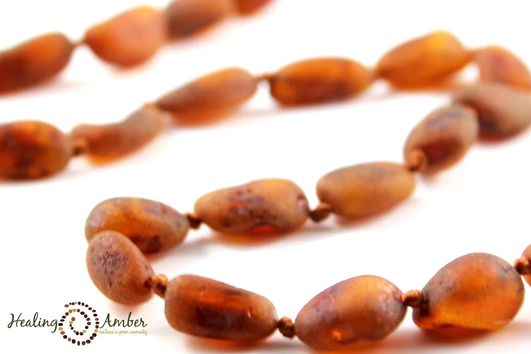 Baltic Amber Bracelet/Anklet - Circle - 6.5"