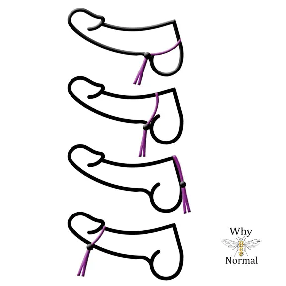 Chain Penis Noose with Rainbow